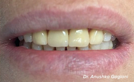 Chicago Cosmetic Dentist