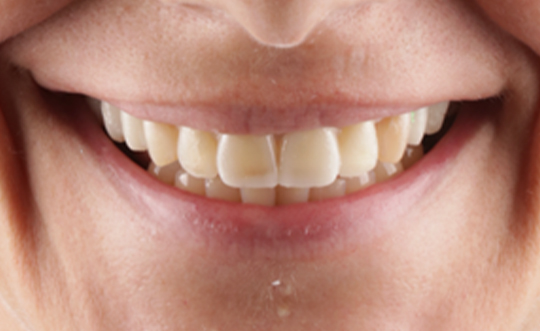 TruBlu Dentistry | Botox reg , E4D and CBCT