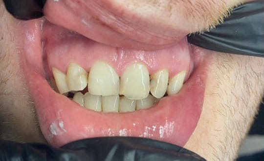 Family Dentist in Chicago