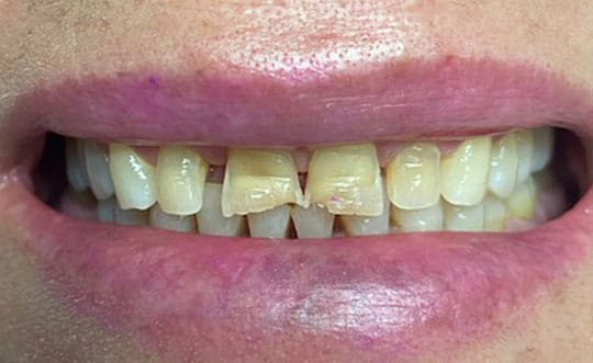 Family Dentist in Chicago