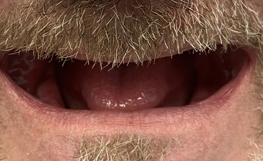 Dental Implants Dentist in Chicago