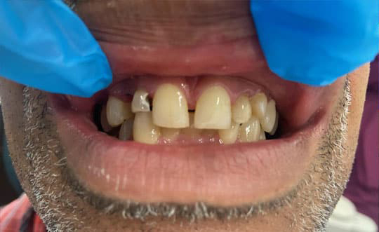 Chicago Cosmetic Dentist