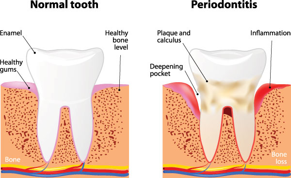 TruBlu Dentistry | Invisalign reg , Digital Impressions and Digital Radiography