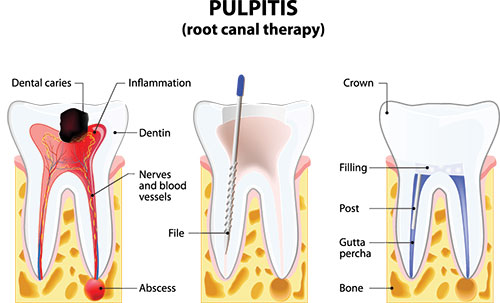 TruBlu Dentistry | Night Guards, Sleep Apnea and Oral Cancer Screening