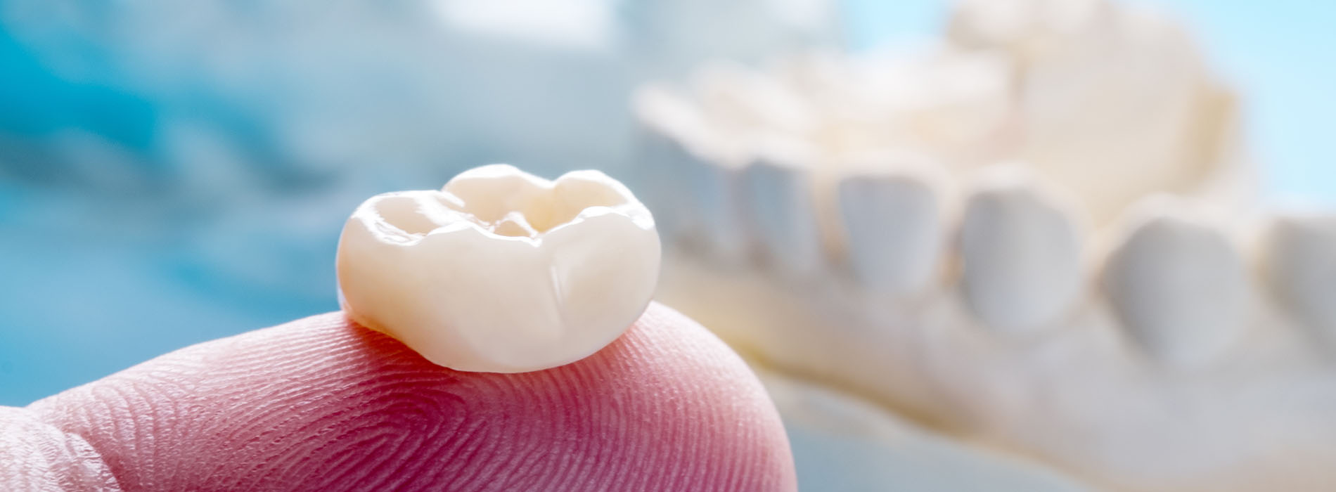 TruBlu Dentistry | Digital Radiography, All-on-4 reg  and Periodontal Treatment