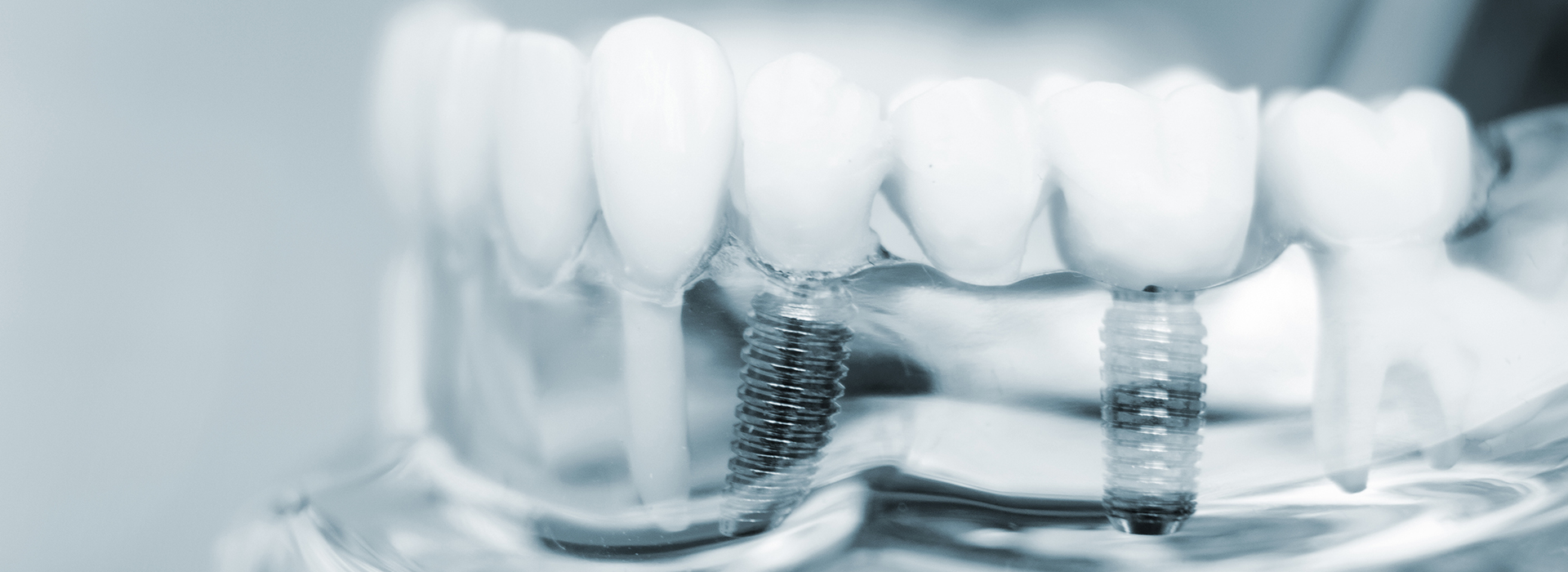 TruBlu Dentistry | CBCT, TMJ Disorders and Dental Fillings